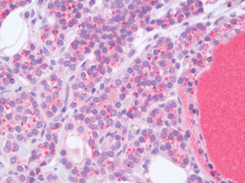 HPSE/Heparanase Antibody