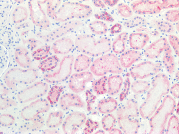 KRT18/CK18/Cytokeratin 18 Antibody