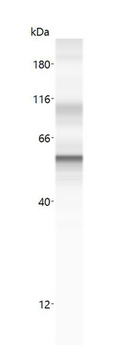 KRT18/CK18/Cytokeratin 18 Antibody