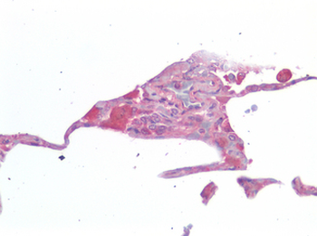 IL-33 Antibody