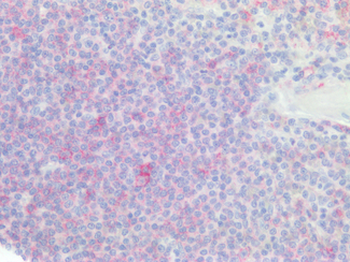 CD20 Antibody