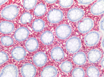 Vimentin Antibody