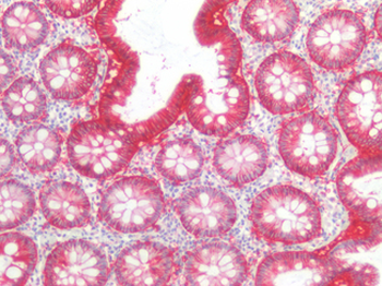 EPCAM Antibody