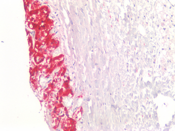 CHGA/Chromogranin A Antibody