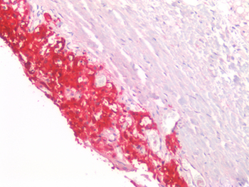 CHGA/Chromogranin A Antibody