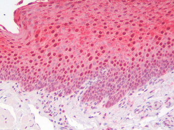 ANXA1/Annexin A1 Antibody