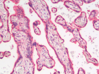 ANXA1/Annexin A1 Antibody