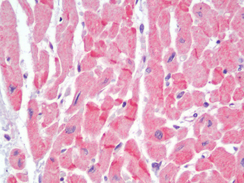 CDH2/N Cadherin Antibody