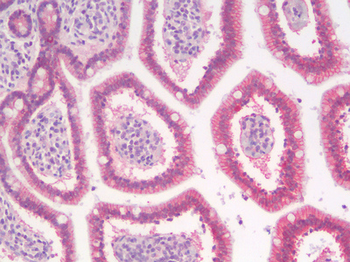 CTNNB1/Beta Catenin Antibody