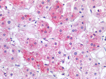 CTNNB1/Beta Catenin Antibody