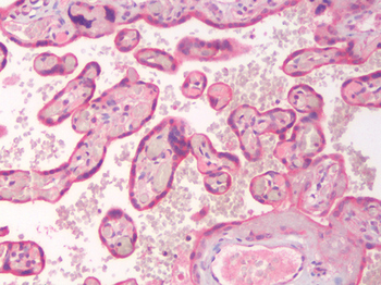 ERG Antibody