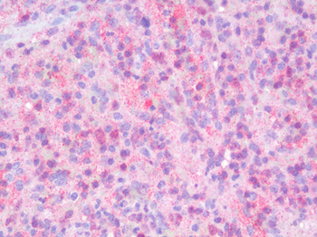 CD2 Antibody