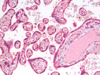 ERG Antibody