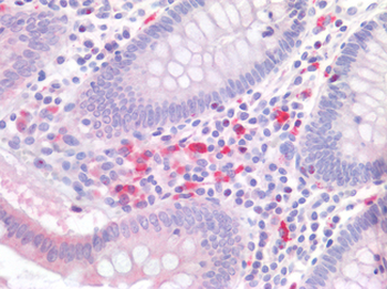 IL17A Antibody