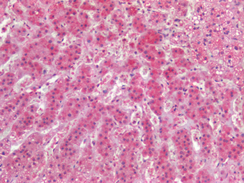 HAVCR1/KIM-1 Antibody