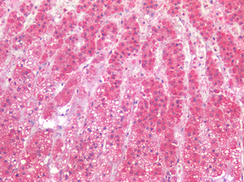 HAVCR1/KIM-1 Antibody