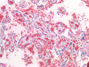 HBA2/Hemoglobin Alpha 2 Antibody
