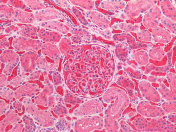 HBA2/Hemoglobin Alpha 2 Antibody