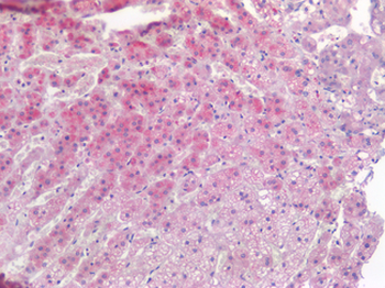 TIAM1 Antibody