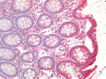 TJP1/ZO-1 Antibody