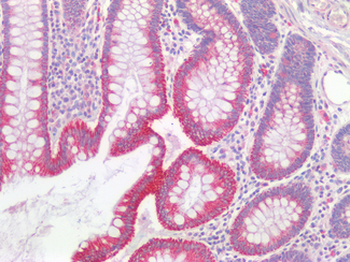 TJP1/ZO-1 Antibody