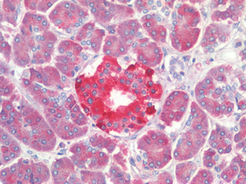 PTP1B Antibody