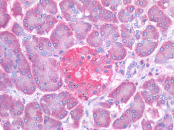 PTP1B Antibody
