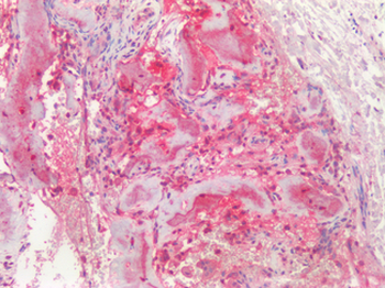Osteocalcin Antibody