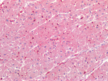 LAMA1/Laminin Alpha 1 Antibody