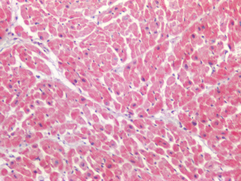 LAMA1/Laminin Alpha 1 Antibody