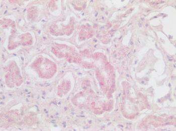 CXCR6 Antibody