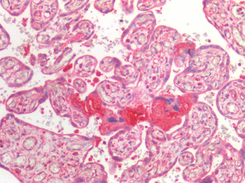 BCL2/Bcl-2 Antibody