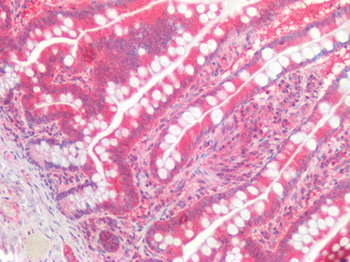 GATA3 Antibody