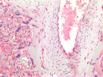 VEGFA/VEGF Antibody