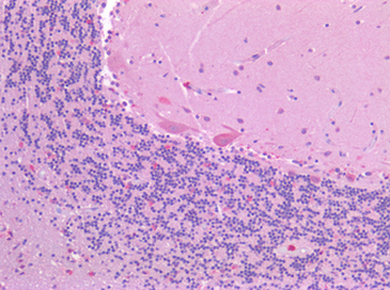 CSMD1 Antibody