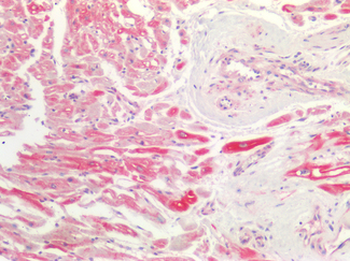 SMAD3 Antibody