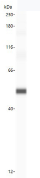 5-Alpha Reductase/SRD5A1 Antibody