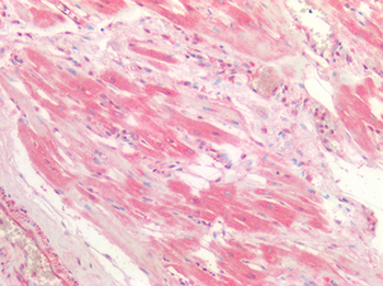 CTSK/Cathepsin K Antibody