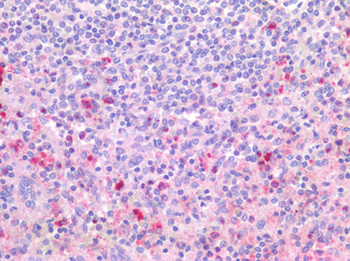 TLR8 Antibody