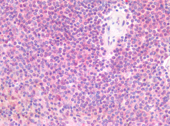 TLR8 Antibody