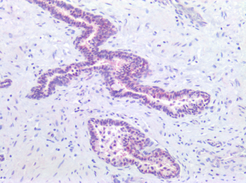 PARP1 Antibody