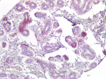 DLX2 Antibody