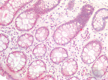 SMAD3 Antibody