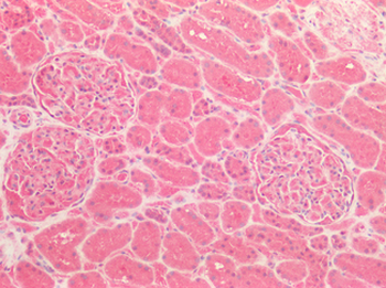 ICAM-1/CD54 Antibody