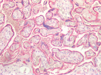 KRT7/CK7/Cytokeratin 7 Antibody