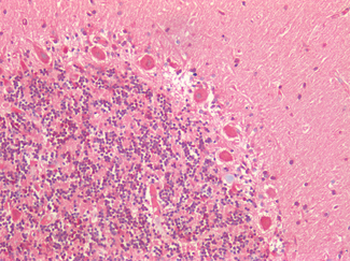 ATG16L1/ATG16L Antibody