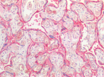 KRT5/CK5/Cytokeratin 5 Antibody