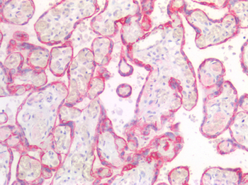KRT5/CK5/Cytokeratin 5 Antibody