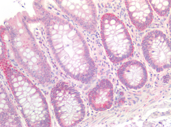 CLDN3/Claudin 3 Antibody