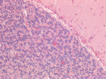 FOLH1/PSMA Antibody